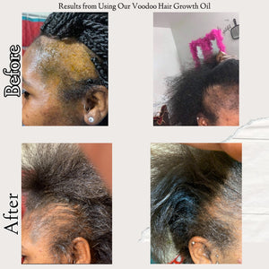 Natural Voodoo Hair Growth Oil