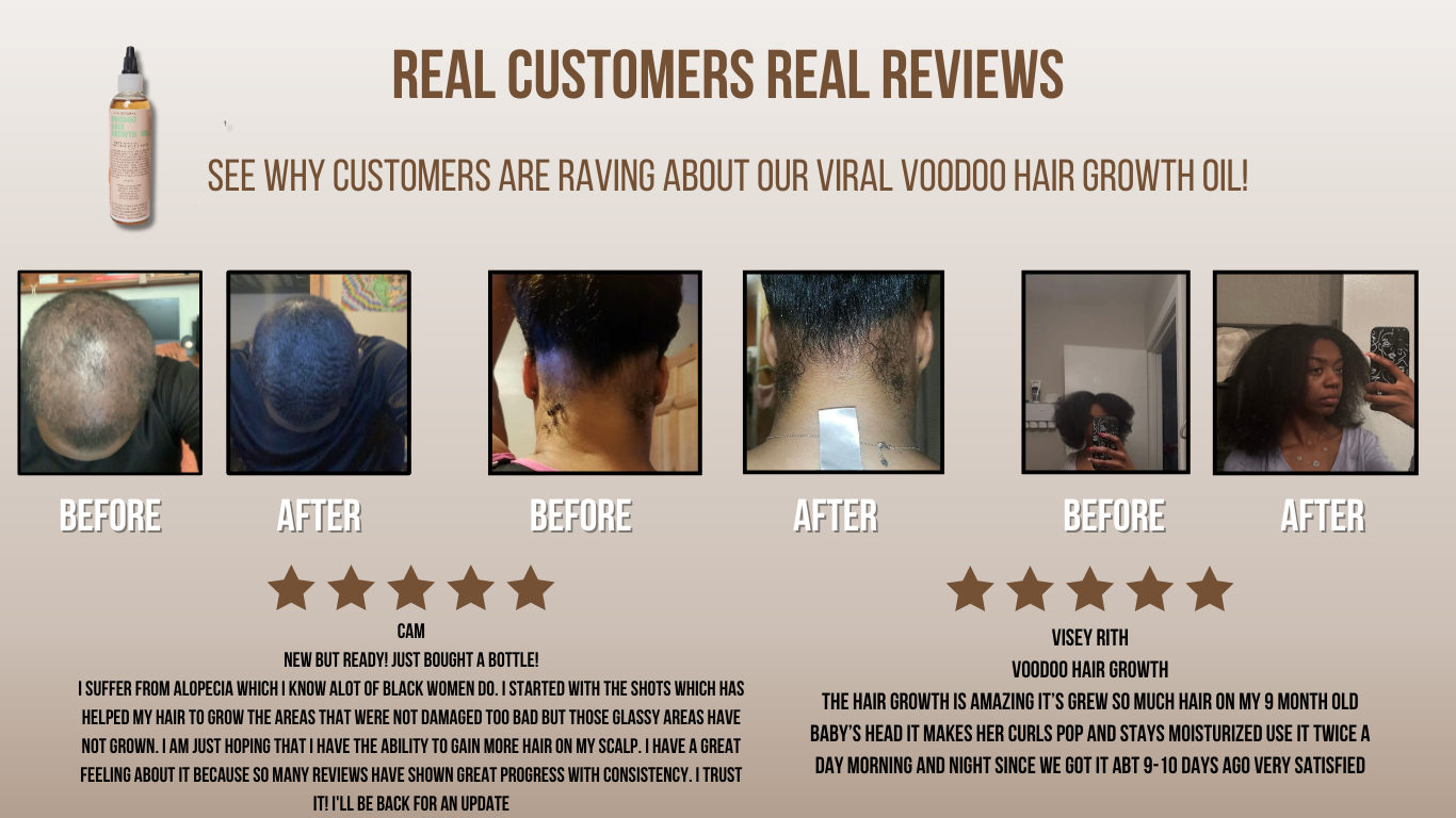 Natural Voodoo Hair Growth Oil - Glossed By Nae Cosemetics